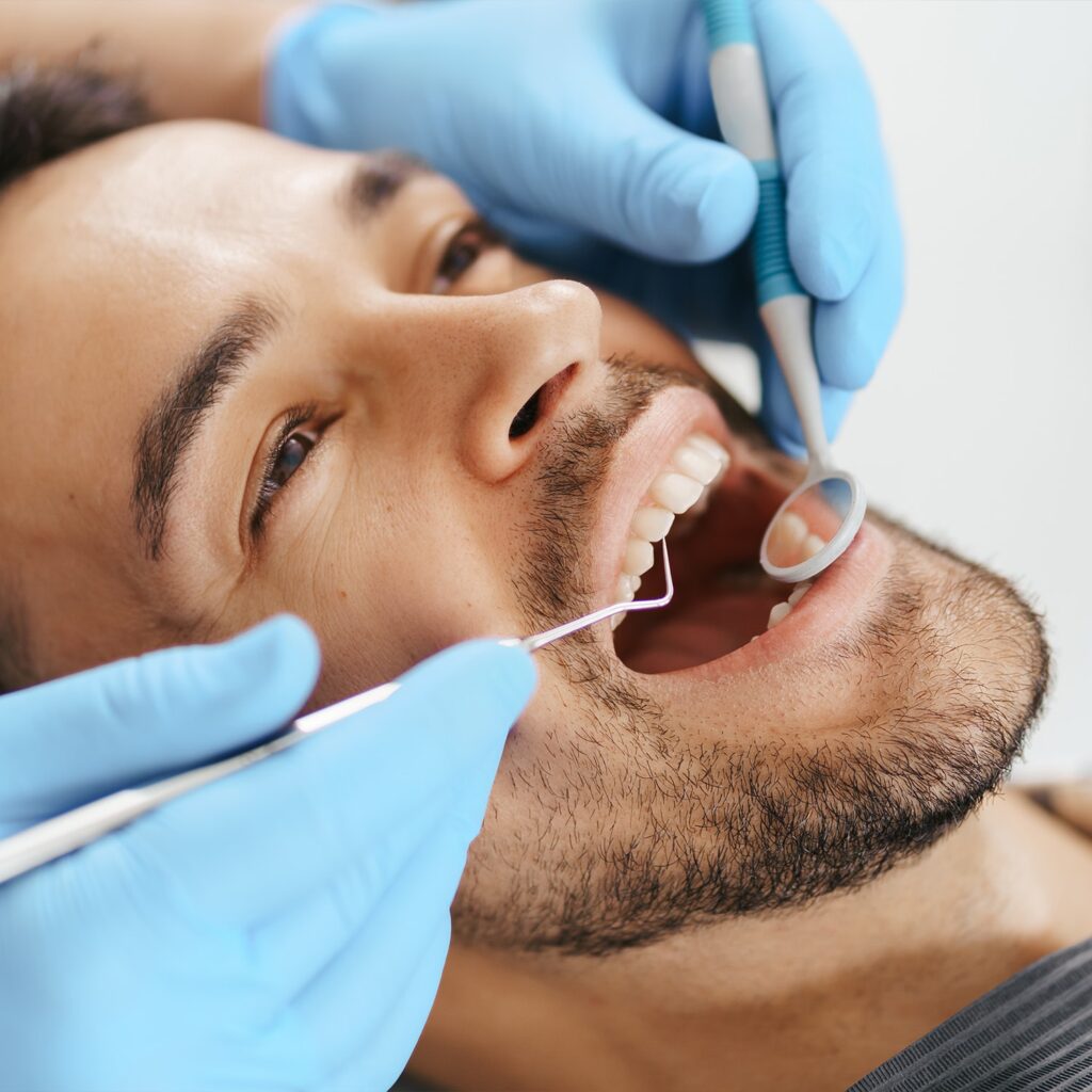 Carie su dente devitalizzato