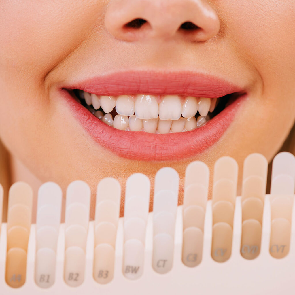 Estetica del Sorriso