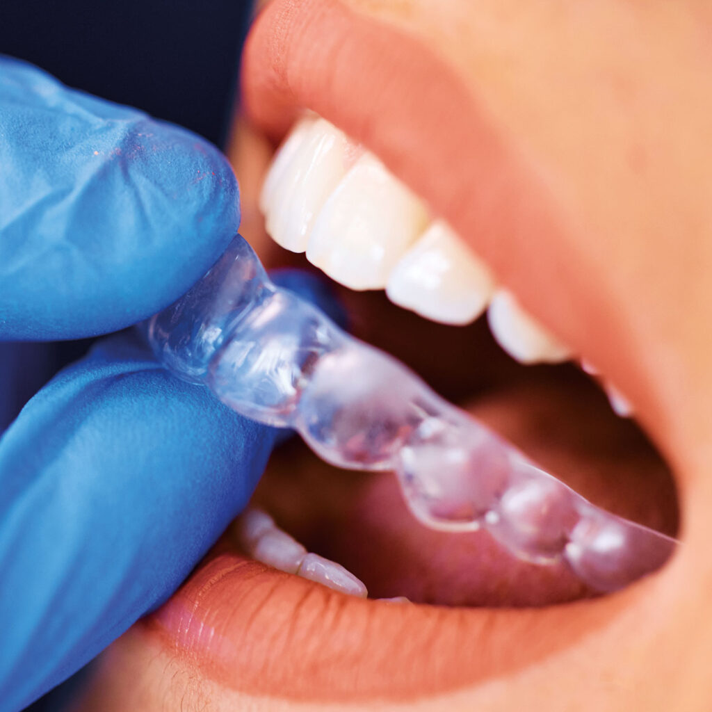 Apparecchio Trasparente