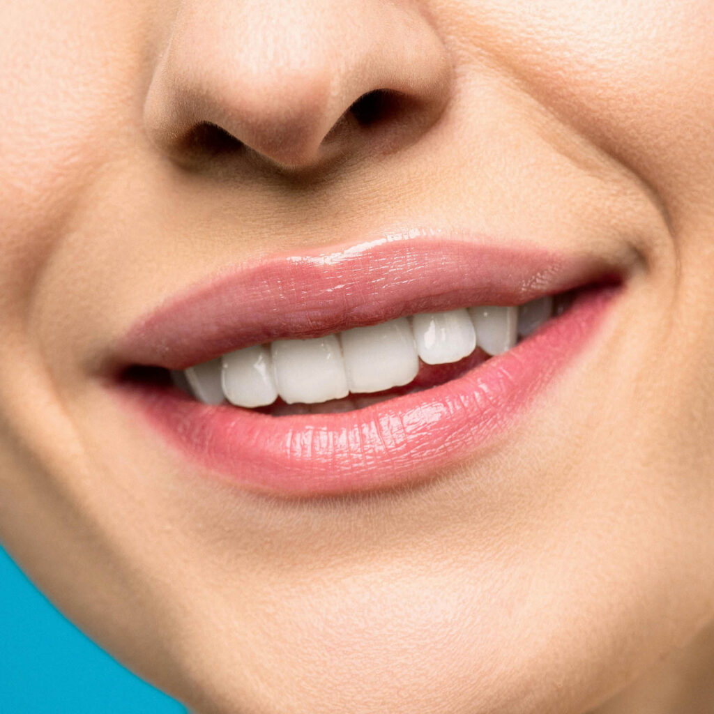 Impianti Dentali Senza Bisturi