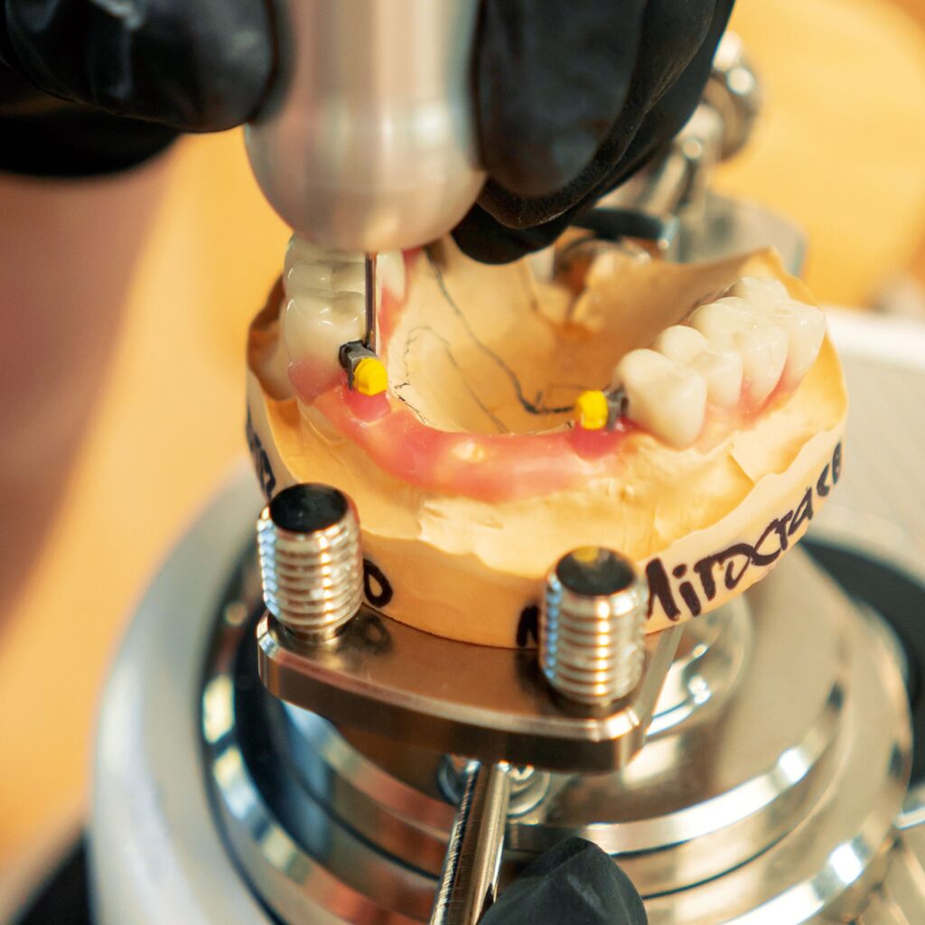 Costo Protesi Dentale