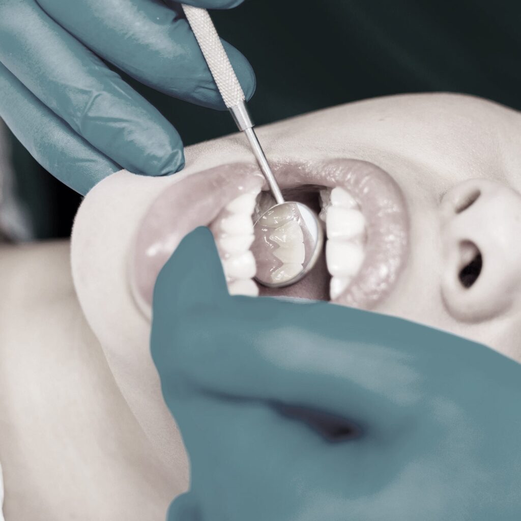 Dente del Giudizio a 40 Anni