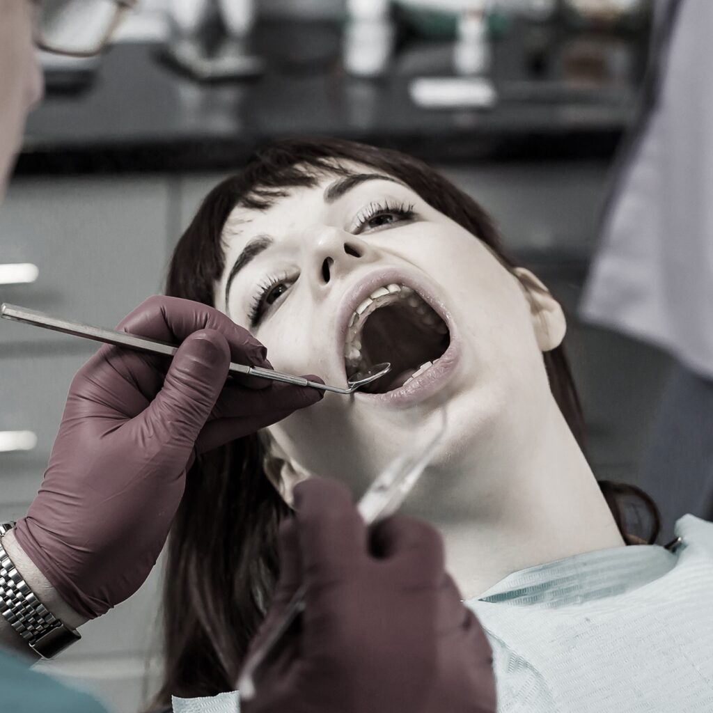 Denti Storti Bambini