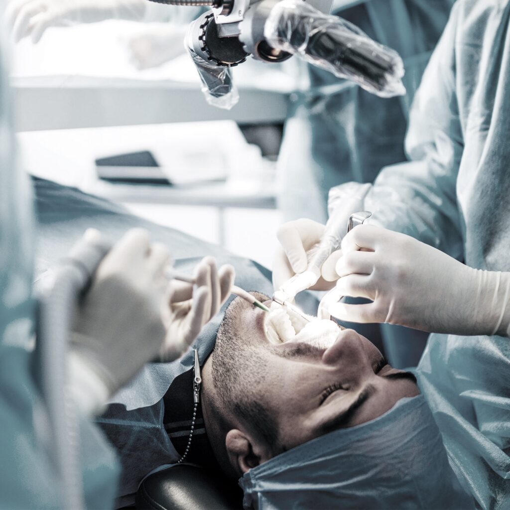 Estrazione di Radice Dentale