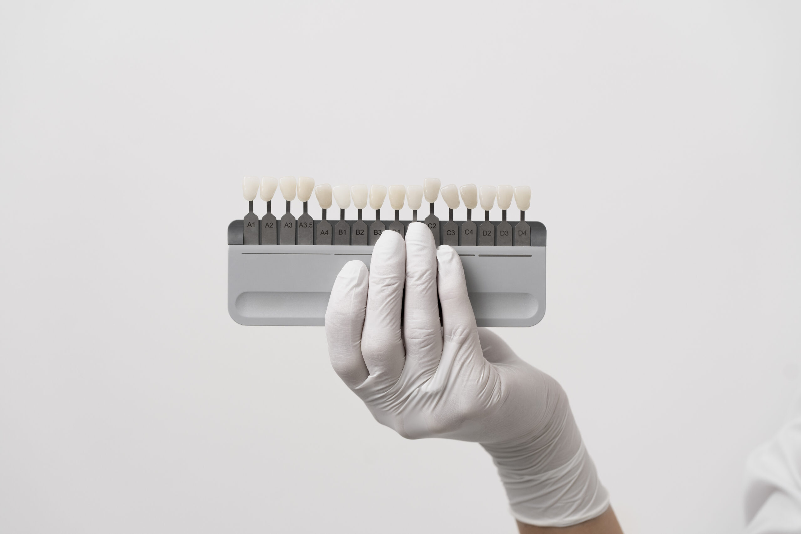 Le Migliori Faccette Dentali